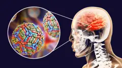 வெஸ்ட் நைல் வைரஸ்