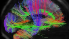 Imagem de scan de um cérebro