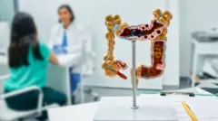 Crohn y colitis ulcerosa: hallan la principal causa de la enfermedad inflamatoria intestinal que afecta a millones de personas 1 Médica y paciente