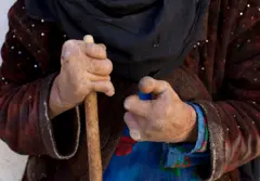 لېپروسي