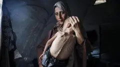 ሃዳያ በረሃብ የተጎዳ ልጇን ታቅፋ