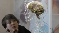 Ilustrasi otak manusia. 