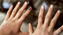 వేలి గోళ్లు