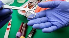 Organ removal