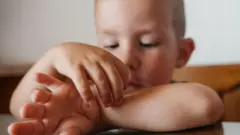 کودکی در حال خاراندن محل گزش پشه