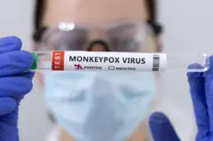 Cacar monyet