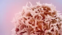 Micrografia eletrônica colorida de uma célula T ou linfócito T. Seu aspecto é similar a uma esponja, com bordas parecidas com pétalas de flores.