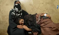 Lokacin da BBC ta kai ziyara asibitin Civil Hospital, kusan duk waɗanda suka kai akn su sashen kulawar gaggawa sun je saboda bugun zafi 