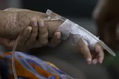 হাম আক্রান্ত শিশু