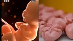 Awọn ọlẹ in oloyun