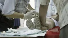 ختنے ، فائل فوٹو