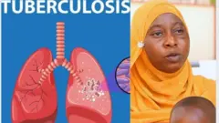 Obinrin ti ọmọ rẹ ni arun ikọ ise