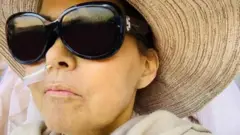 یوه ناروغه مېرمن تورې عینکې یې پر سترګو دي.