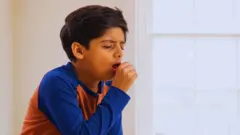 ગાલપચોળિયાં