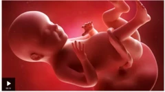 Aworan ọmọ ikoko pẹlu ìwọ́ 