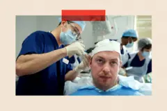 Un cirujano realiza un trasplante de cabello a un hombre.