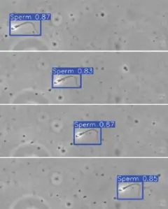 Imagem de microscópio com detecção de espermatozoides, destacados em quadrados azuis