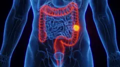Cáncer colorrectal