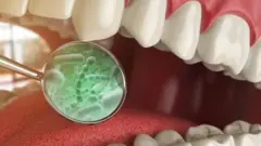 SX