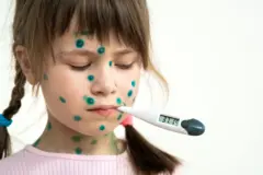 जगभरात गोवराचा संसर्ग का वाढतोय? गोवर किती धोकादायक असतो?