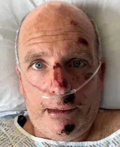 පාපැදි අනතුරෙන් පසු ග්ලෙන් සතියක් පමණ බරපතළ අනතුරු අංශයේ ප්‍රතිකාර ලැබීය