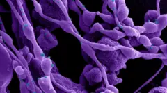 कोविड से संक्रमित एक कोशिका.