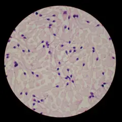 Amostra de sêmen colorida ao microscópio, com os espermatozoides tingidos de roxo