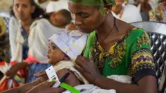 እናቱ የያዘችው ህጻን በምግብ እጥረት የተጠቃ መሆኑን ለማረጋገጥ የእጁ ዙሪያ እየተለካ