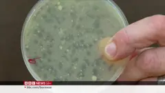 တိရစ္ဆာန်တွေရဲ့ ဗိုင်းရပ်စ်ကို ကြည့်ပြီး လူတွေရဲ့ ကူးစက်ရောဂါ ကုသဖို့ ကြိုးပမ်း