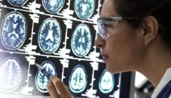 طبيبة تنظر إلى فحوصات الدماغ