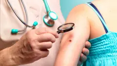 कॅन्सर