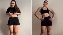 Tânia mostra às seguidoras resultado com tratamento que inclui alimentação, exercício e cirurgia