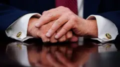 يداه الرئيس الأمريكي دونالد ترامب
