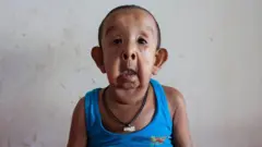 বায়জিদ শিকদার: চার বছর বয়সেই বৃদ্ধ মানুষের মতো উপসর্গ ছিল তার