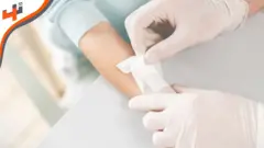 تقنية جديدة لالتمام الجروح بسرعة