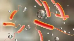 Cholera