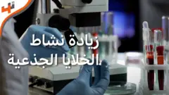 جامعة كامبريدج: زيادة فعالية الخلايا الجذعية في المختبر