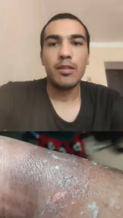 Yigit va jarohat olgan bilak