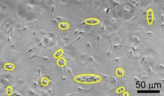 ภาพขยายสเปิร์มที่จับกลุ่มกันเพื่อเคลื่อนตัวไปข้างหน้า