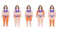 Qué es el lipedema, la enfermedad por la que el cuerpo acumula grasa desproporcionadamente (y 6 consejos para hacerle frente) 1 Dibujo de varias mujeres con la enfermedad.