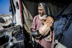 Una madre en Gaza con su hijo desnutrido.