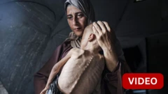 காஸா: உலகை உலுக்கிய படத்தில் உள்ள குழந்தை யார்? புகைப்படக் கலைஞர் விளக்கம்