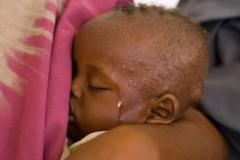 Illoli 7 da zafin rana ke yi wa ƙananan yara da yadda za a kauce musu