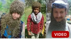 முகத்தில் தேனீ வளர்க்கும் சிறுவன்