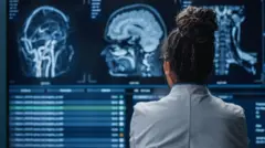 Cerebro