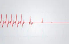 হৃদ স্পন্দন