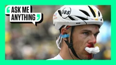 Emilien Jeanniere with a bloody nose and an Ask Me Anything border around him