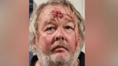 Christopher Mills, de cabelos brancos e barba, com um grande corte na testa.