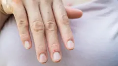 Foto de uma mão com as unhas curtas.