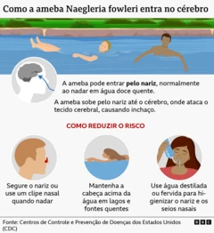 Gráfico mostrando as rotas de entrada da "ameba comedora de cérebros" e como evitar a infecção